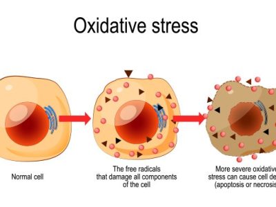 Stress Oxy hóa